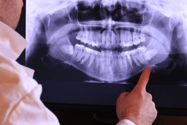 Best Emergency Gum Treatment in Milton, WA